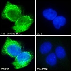 G-Protein Coupled Receptor 94 (GPR94) Antibody