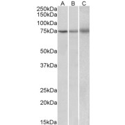 abx430407 (2 µg/ml) staining of Human (A), Mouse (B) and Rat (C) Spleen lysate (35 µg protein in RIPA buffer). Primary incubation was 1 hour. Detected by chemiluminescence.