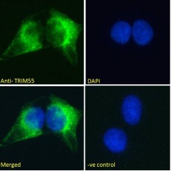 Muscle-Specific RING Finger Protein 2 (MURF2) Antibody
