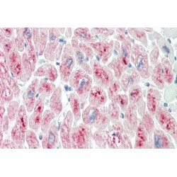 Muscle-Specific RING Finger Protein 2 (MURF2) Antibody