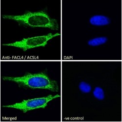 Long-Chain-Fatty-Acid-CoA Ligase 4 (FACL4) Antibody