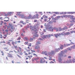 Long-Chain-Fatty-Acid-CoA Ligase 4 (FACL4) Antibody