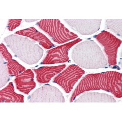 Receptor-Binding Cancer Antigen Expressed On SiSo Cells (EBAG9) Antibody