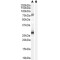 Receptor-Binding Cancer Antigen Expressed On SiSo Cells (EBAG9) Antibody