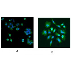 High Sensitive Parkinson Disease Protein 7 (PARK7) Antibody