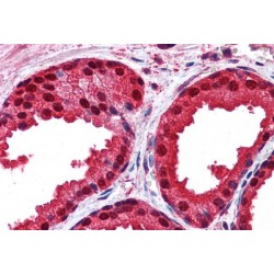 High Sensitive Parkinson Disease Protein 7 (PARK7) Antibody