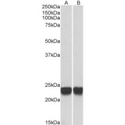 abx430436 (0.001 µg/ml) staining of HeLa (A) and Jurkat (B) lysates (35 µg protein in RIPA buffer). Detected by chemiluminescence.