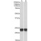 High Sensitive Parkinson Disease Protein 7 (PARK7) Antibody