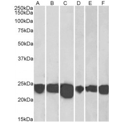 High Sensitive Parkinson Disease Protein 7 (PARK7) Antibody