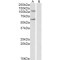 Iron-Responsive Element Binding Protein 2 (IREB2) Antibody