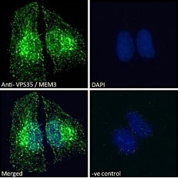 Vacuolar Protein Sorting-Associated Protein 35 (VPS35) Antibody