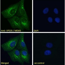 Vacuolar Protein Sorting-Associated Protein 35 (VPS35) Antibody