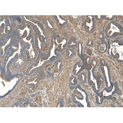 Vacuolar Protein Sorting-Associated Protein 35 (VPS35) Antibody