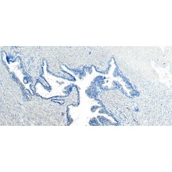 Vacuolar Protein Sorting-Associated Protein 35 (VPS35) Antibody