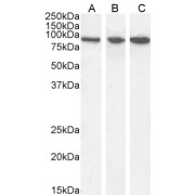 abx430442 (0.03 µg/ml) staining of Human (A) Mouse (B) and Rat (C) Brain lysate (35 µg protein in RIPA buffer). Detected by chemiluminescence.