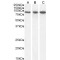 Vacuolar Protein Sorting-Associated Protein 35 (VPS35) Antibody