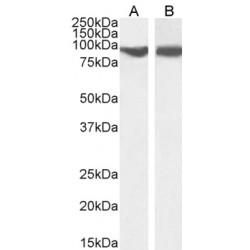 Vacuolar Protein Sorting-Associated Protein 35 (VPS35) Antibody