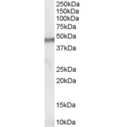 abx430446 (2 µg/ml) staining of nuclear HEK293 (A) and (1 µg/ml) Human Breast cancer (B) lysate (35 µg protein in RIPA buffer). Detected by chemiluminescence.