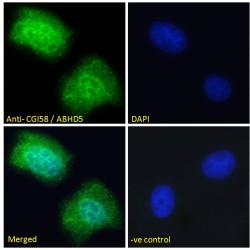 Lipid Droplet-Binding Protein CGI-58 (CGI58) Antibody