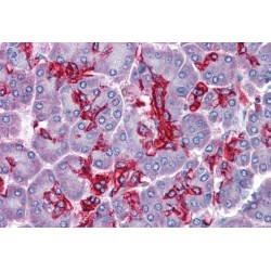 Lipid Droplet-Binding Protein CGI-58 (CGI58) Antibody