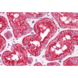 Lipid Droplet-Binding Protein CGI-58 (CGI58) Antibody