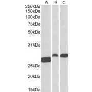abx430449 (0.1 µg/ml) staining of Human Tonsil (A) and Rat (B) and Pig (C) Spleen lysate (35 µg protein in RIPA buffer). Primary incubation was 1 hour. Detected by chemiluminescence.