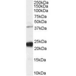 GIPC PDZ Domain Containing Family, Member 1 (GIPC1) Antibody