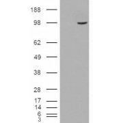 HEK293 overexpressing SMEK1 and probed with abx430454 (mock transfection in first lane).