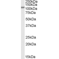 SMEK Homolog 1 (SMEK1) Antibody