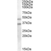 abx430456