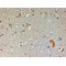 C-Terminal PDZ Ligand of Neuronal Nitric Oxide Synthase Protein (CAPON) Antibody