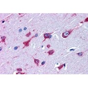 abx430481 (3.8 µg/ml staining of paraffin embedded Human Cortex. Steamed antigen retrieval with citrate buffer pH 6, AP-staining.