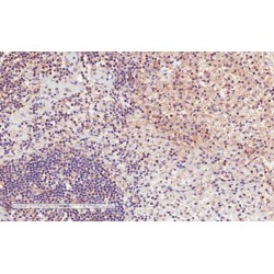 Integrin Alpha-L (ITGAL) Antibody