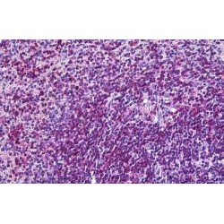 Integrin Alpha-L (ITGAL) Antibody