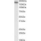 Integrin Alpha-L (ITGAL) Antibody