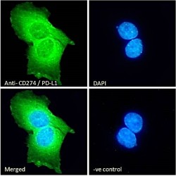 Programmed Cell Death 1 Ligand 1 (CD274) Antibody