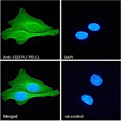 Programmed Cell Death 1 Ligand 1 (CD274) Antibody