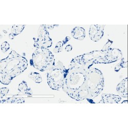 Programmed Cell Death 1 Ligand 1 (CD274) Antibody