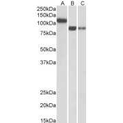 abx430493 (0.3 µg/ml) staining of Human Heart (A), Amygdala (B) and Hippocampus (C) lysates (35 µg protein in RIPA buffer). Primary incubation was 1 hour. Detected by chemiluminescence.