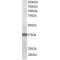 C-Terminal LIM Domain Protein 1 (CLIM1) Antibody