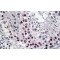 DENTT Antibody