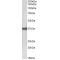 Epithelial Cell Adhesion Molecule (EPCAM) Antibody
