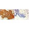 Receptor Tyrosine-Protein Kinase ErbB-2 (ERBB2) Antibody