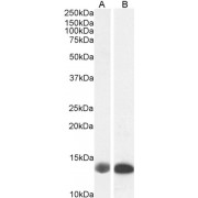 abx430516 (0.1 µg/ml) staining of Human (A) and Pig (B) Liver lysate (35 µg protein in RIPA buffer). Primary incubation was 1 hour. Detected by chemiluminescence.