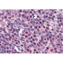 Fanconi Anemia Group G Protein (FANCG) Antibody