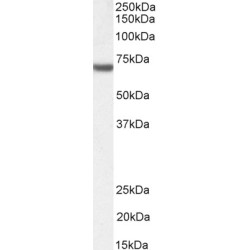 Fanconi Anemia Group G Protein (FANCG) Antibody