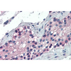 Forkhead Box E1 (FOXE1) Antibody