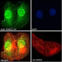 ILF (Isoform 1) Antibody