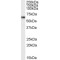 Forkhead Box Protein O4 (FOXO4) Antibody
