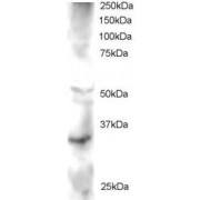 abx430532 staining (2 µg/ml) of Human Heart lysate (RIPA buffer, 30 µg total protein per lane). Primary incubated for 1 hour. Detected by western blot using chemiluminescence.